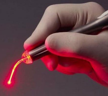 Laser Treatment